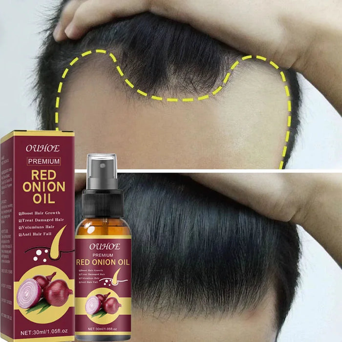 Powerful Hair Growth Serum Spray Anti Hairs Loss Treatment Essence Repair Nourish Roots Regrowth Hair Care Product For Men Women