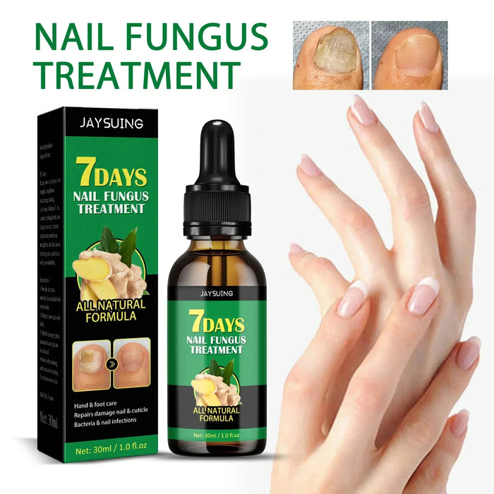 7DAYS Repair Nail Fungus Treatments Essence Foot Care Serum Toe Nails Fungal Removal Gel Anti-Infection Onychomycosis Care Tool