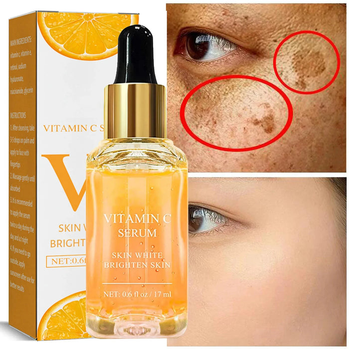 Vitamin C Whitening Serum Face Remove Dark Spots Freckles Fade Melanin Retinol Anti-wrinkle Essence Brightening Korean Skincare