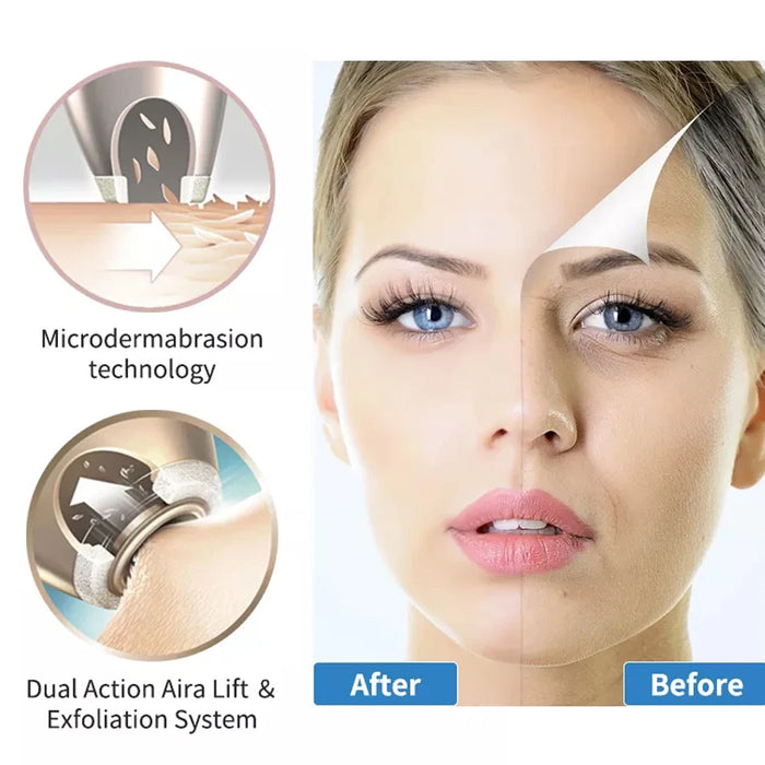 Portable Diamond Microdermabrasion Machine For Blackhead Removal Acne Clearning Skin Rejuvenation Home Facial SPA Tool