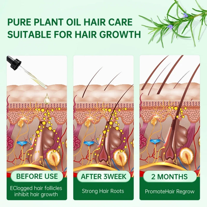 Hair Growth Serum Fast Regrowth Oil Anti Hair Loss Prevent Baldness Thinning Herbal Hair Growth Treatment Thicken Grow Hair Care