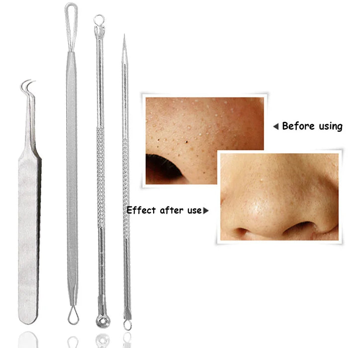 BlackHead Remover Tool Black Head Acne Blemish Pimple Extractor Acne Needles Tweezer Pore Cleaner Face Cleansing Tools Skin Care