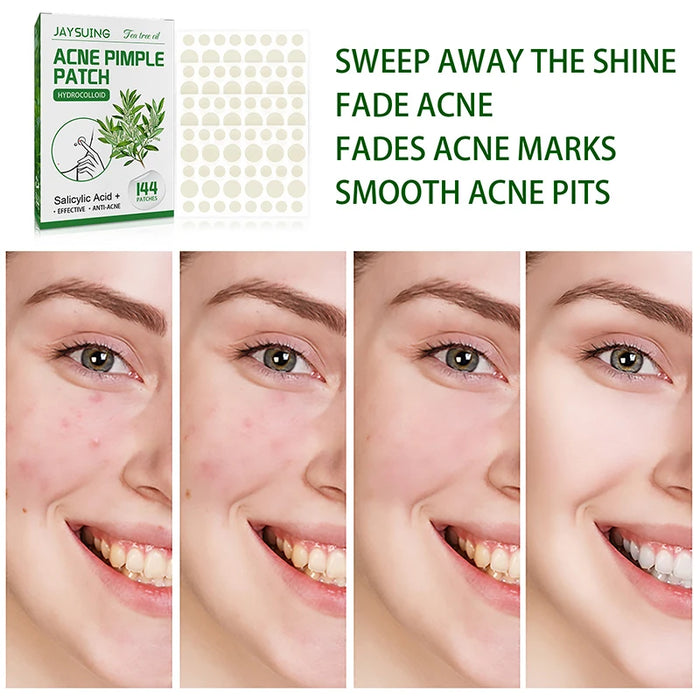 144Pcs Acne Pimple Patch Stickers Waterproof Acne Treatment Pimple Remover Tool Blemish Spot Facial Mask Skin Care