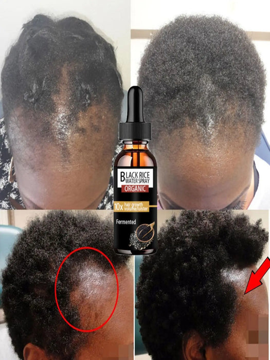 2022 New Hair Growth Oil for Black Women Serum Thick Long Hair Powerful Beard Growth Serum