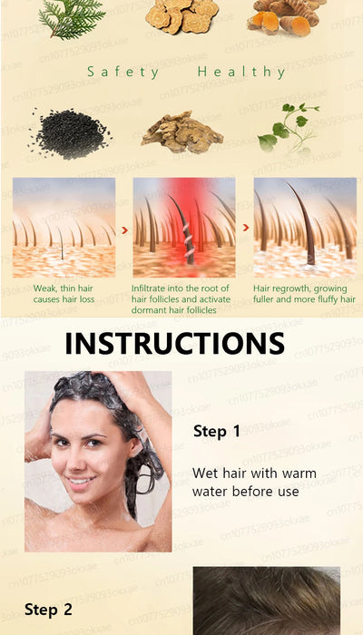 Hair growth products to quickly repair hair loss, hereditary hair loss, seborrheic alopecia