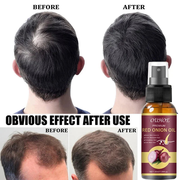 Powerful Hair Growth Serum Spray Anti Hairs Loss Treatment Essence Repair Nourish Roots Regrowth Hair Care Product For Men Women