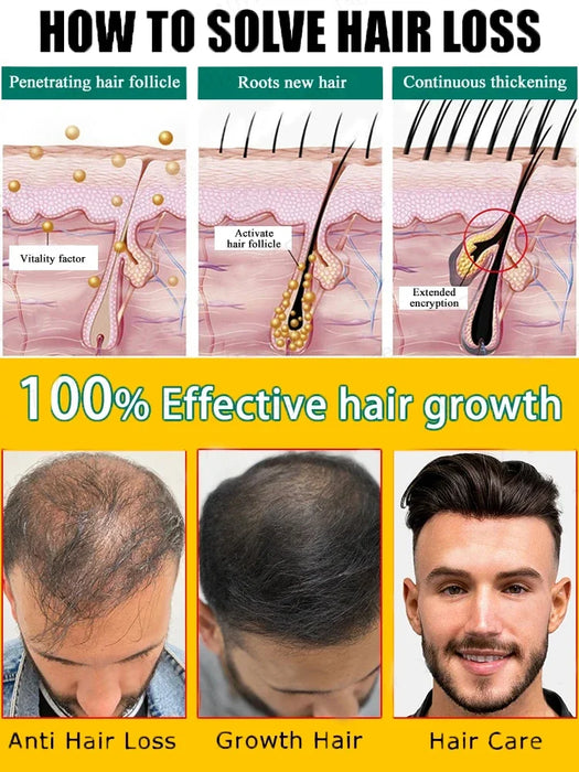 Fast Hair Growth Hair Growth Oil Effective Baldness Repair Hereditary Loss Postpartum  Loss Seborrheic Hair Anti Loss