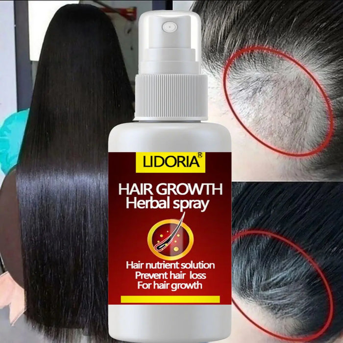 LIDORIA Hair Tonic Promote hair growth and nourish hair roots