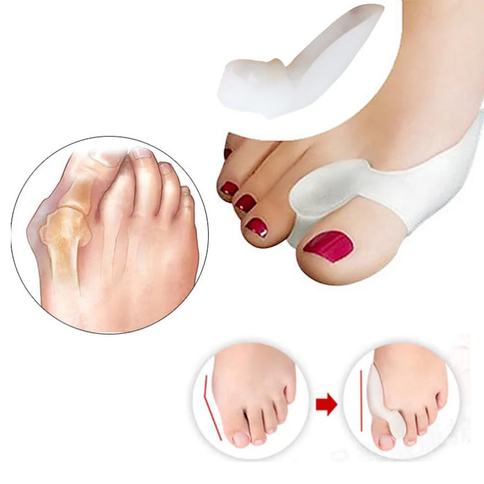 2Pcs=1Pair Silicone Toes Separator Bunion Bone Ectropion Adjuster Toes Outer Appliance Foot Care Tools Hallux Valgus Corrector