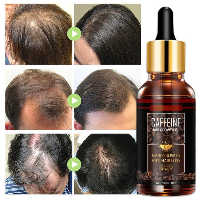 Alopecia Hair Treatment for Women Hairloss Hair Oil Growth Tool Spray Caffeine for Treatment Dry Frizzy Damaged Thin Hair Care