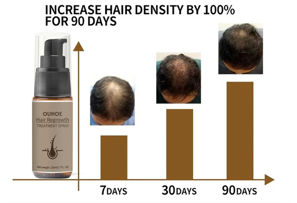 Fast Hair Growth Spray Products Anti Hair Loss Serum Prevent Baldness Treatment Scalp Dry Damaged Essential Oil Hair Beauty