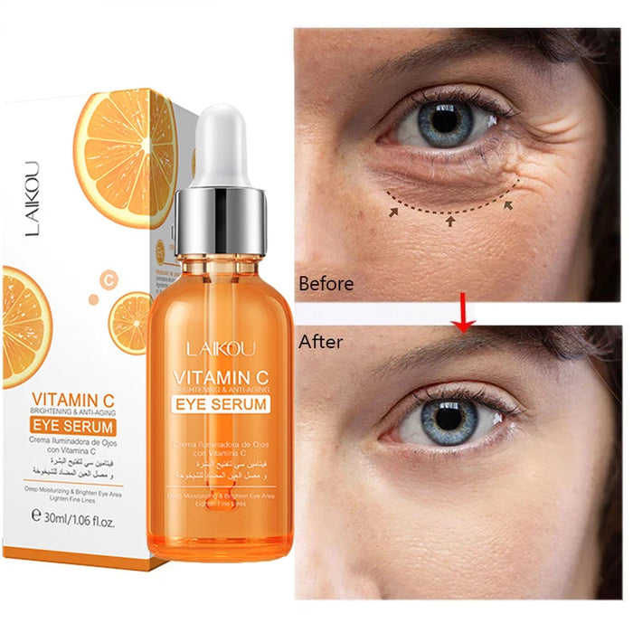 Vitamin C Remove Dark Circles Eye Serum Anti-Wrinkle Fade Fine Line Anti Eye Bag Puffiness Essence Anti-Aging Lift Firm Eye Care