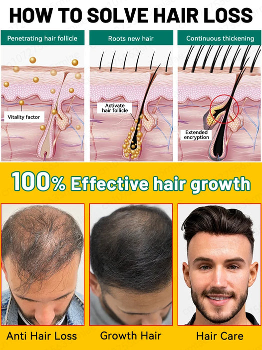 Unisex Growth Oil Hair Loss Treatment Rapid Hair Growth Effective Baldness Repair Hereditary Postpartum Hair Loss