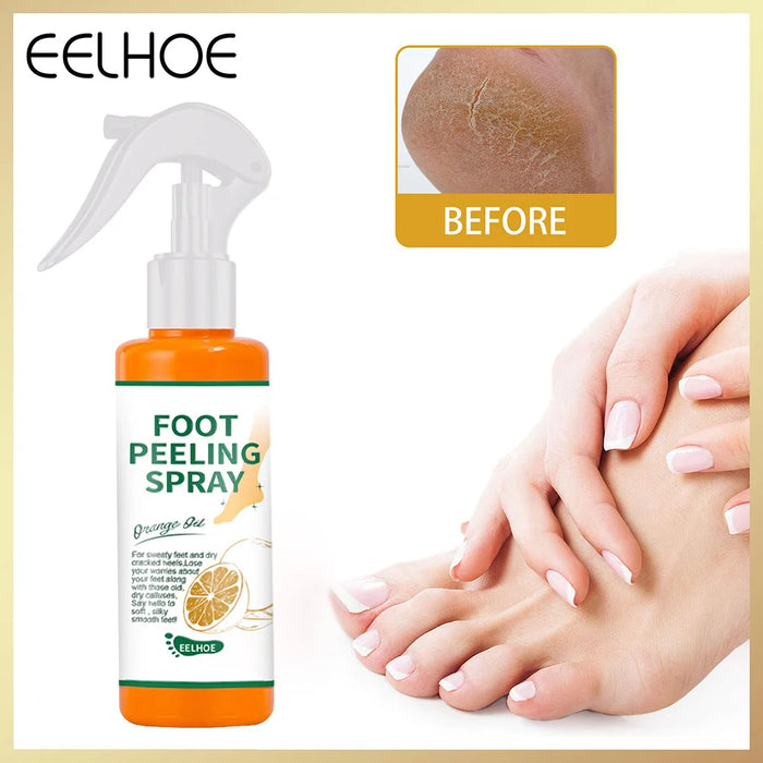 100ml Foot Peeling Spray Orange Essential Oil Exfoliating Peel Dead Skin Remover