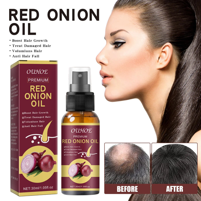 Powerful Hair Growth Serum Spray Anti Hairs Loss Treatment Essence Repair Nourish Roots Regrowth Hair Care Product For Men Women