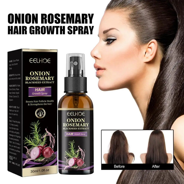 30ml Hair Growth Spray Onion Rosemary Dense Hair Spray Rosemary Essential Oil Hair Nourishing Essential Oil Anti Hair Loss Spray