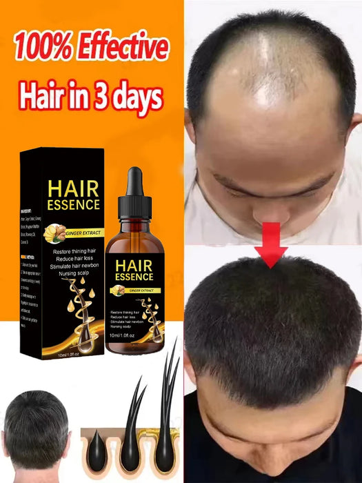 Fast Hair Growth Hair Growth Oil Effective Baldness Repair Hereditary Loss Postpartum  Loss Seborrheic Hair Anti Loss