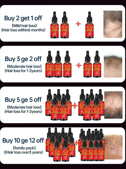 Fast Hair Growth Hair Growth Oil Effective Baldness Repair Hereditary Loss Postpartum  Loss Seborrheic Hair Anti Loss