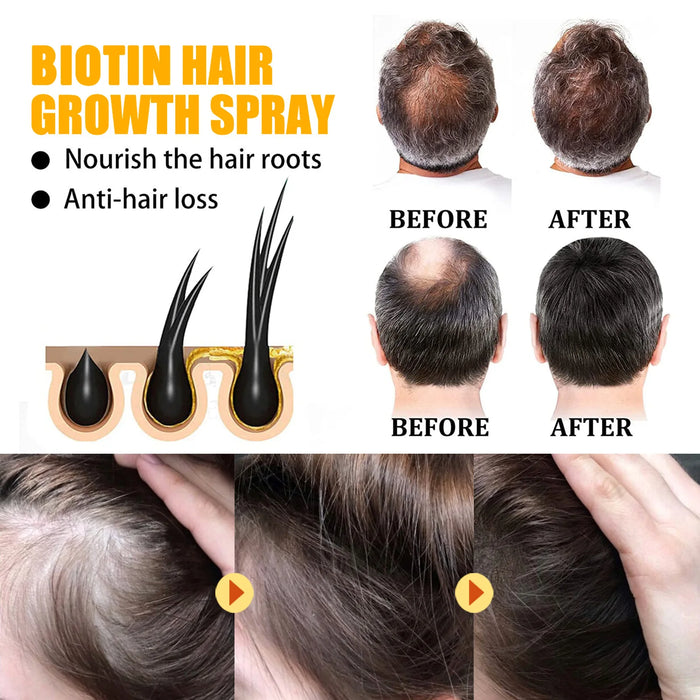 Biotin Hair Growth Spray Anti Dandruff Itching Treatment Dry Frizzy Nourish Scalp Damaged Repair Serum Hair Care Essential Oils