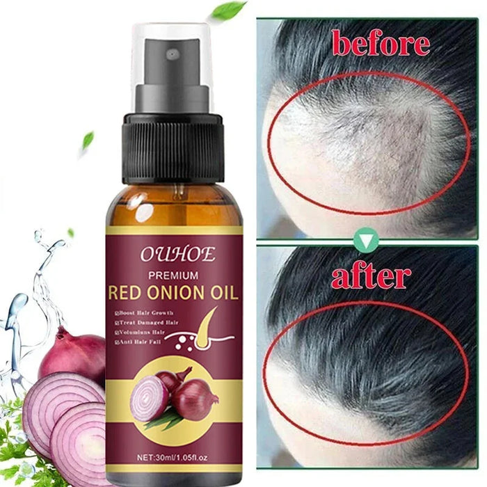 Powerful Hair Growth Serum Spray Anti Hairs Loss Treatment Essence Repair Nourish Roots Regrowth Hair Care Product For Men Women