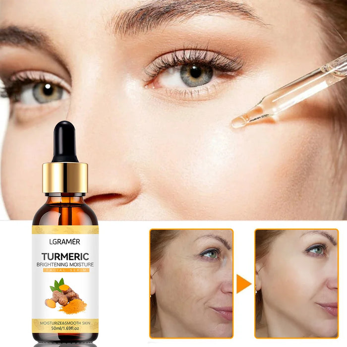 Turmeric Freckle Whitening Serum Anti-oxidant Nourishing Moisturizing Repair Skin Brighten Fade Dark Spot Essence Face Care