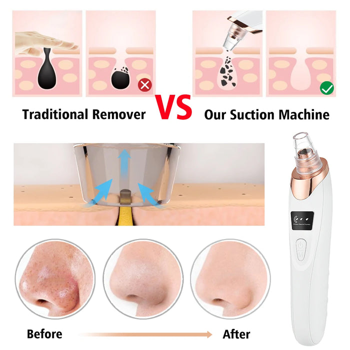 New Blackhead Remover Pore Vacuum Acne Cleaner Black Spots Removal Facial Deep Cleansing Pore Cleaner Machine Skin Care Tools