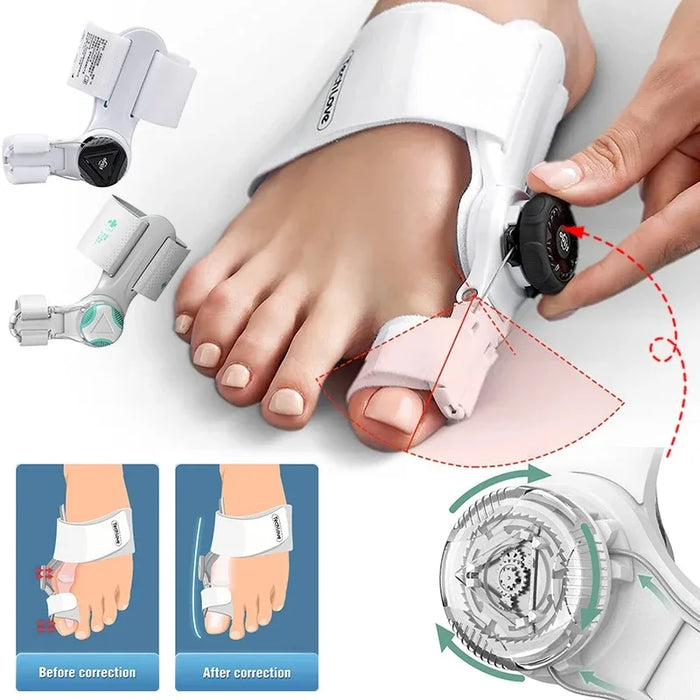 New Bunion Splint Big Toe Straightener Adjustable Corrector Knob Hallux Valgus Correction Orthopedic Supplies Pedicure Foot Care