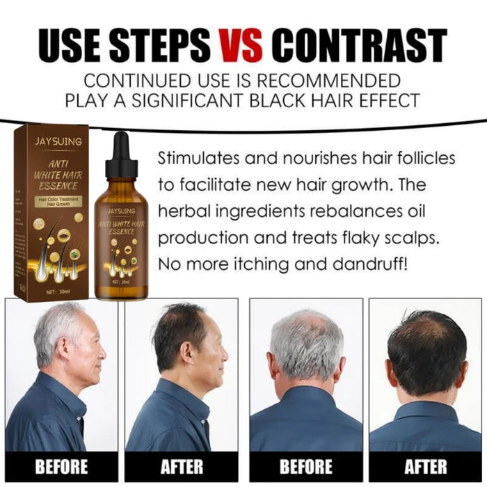 Lasting Anti Gray Hair Treatment Serum White to Black Hair Growth Natural Color Repair Nourish Men Women Anti Hair Loss Products