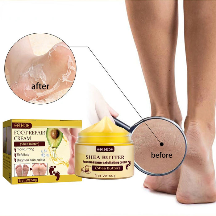 Anti Drying Feet Cream Heel Cracking Repair Products Exfoliation Dead Skin Removal Softening Moisturizing Hands Legs Care Beauty