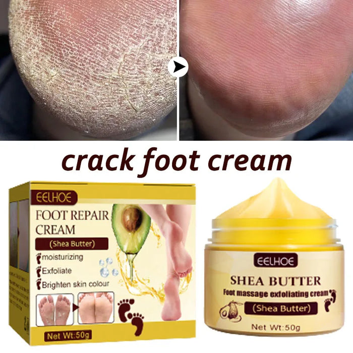 Anti Drying Feet Cream Heel Cracking Repair Products Exfoliation Dead Skin Removal Softening Moisturizing Hands Legs Care Beauty