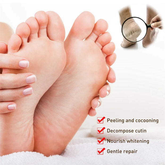 Anti Drying Feet Cream Heel Cracking Repair Products Exfoliation Dead Skin Removal Softening Moisturizing Hands Legs Care Beauty