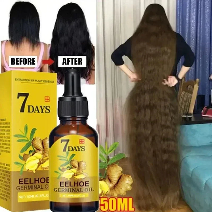 Fast Hair Growth Oil Ginger Growth Hair Treatment Anti Hair Loss Men Women Scalp Treatment Serum Products Beauty Health Product