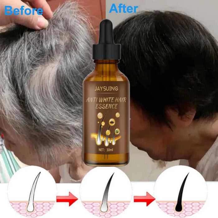 Lasting Anti Gray Hair Treatment Serum White to Black Hair Growth Natural Color Repair Nourish Men Women Anti Hair Loss Products