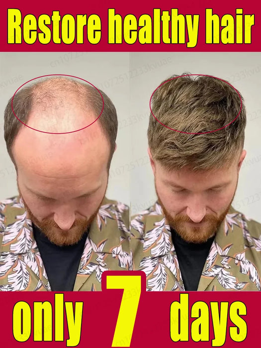 Hair growth essential oil for treating baldness