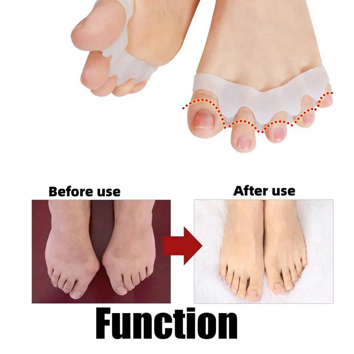 2Pcs=1Pair New Protective Toes Separator  Suitable Bunion Corrector  Material Soft Gel Straightener Spacers Stretchers Care Tool