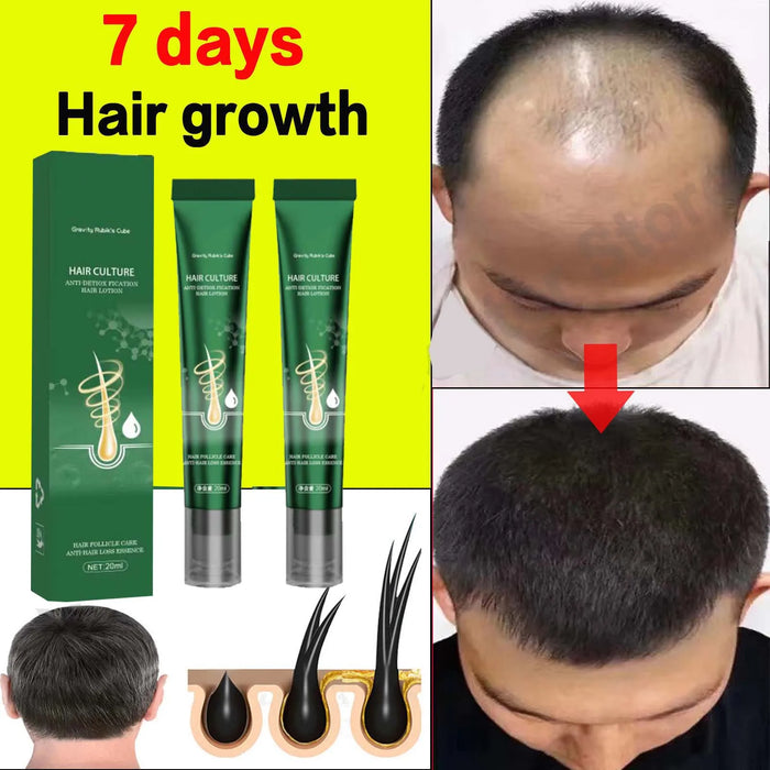 Hair Growth Oil Effective Baldness Repair Hereditary Postpartum Seborrheic Hair Loss for Women & Men Fast Hair Growth Oil