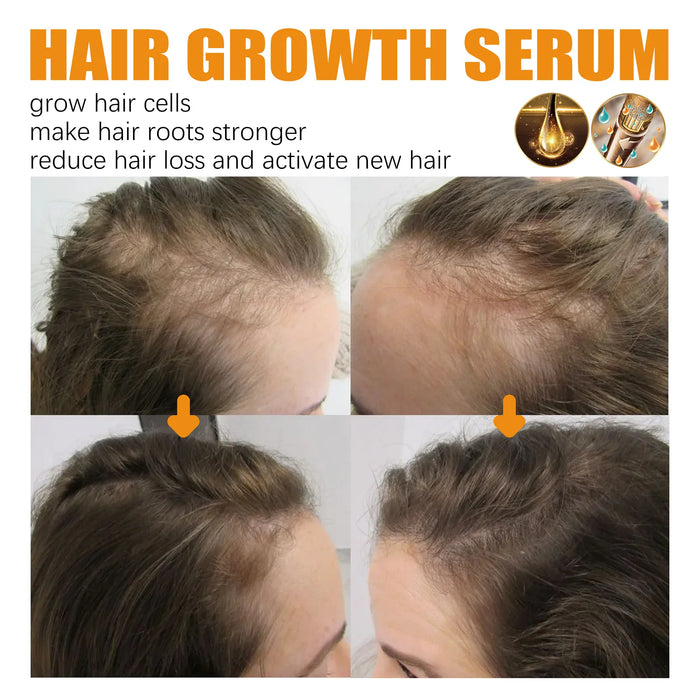 Biotin Hair Growth Spray Anti Dandruff Itching Treatment Dry Frizzy Nourish Scalp Damaged Repair Serum Hair Care Essential Oils