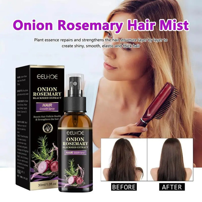 30ml Hair Growth Spray Onion Rosemary Dense Hair Spray Rosemary Essential Oil Hair Nourishing Essential Oil Anti Hair Loss Spray