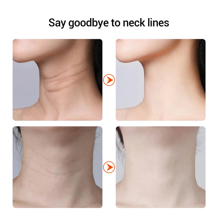 EMS Neck Face Beauty Device LED Photon Therapy Firming Lifting Skin Wrinkle Removal Thin Double Chin Vibration Facial Massager