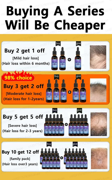 Unisex Growth Oil Hair Loss Treatment Rapid Hair Growth Effective Baldness Repair Hereditary Postpartum Hair Loss