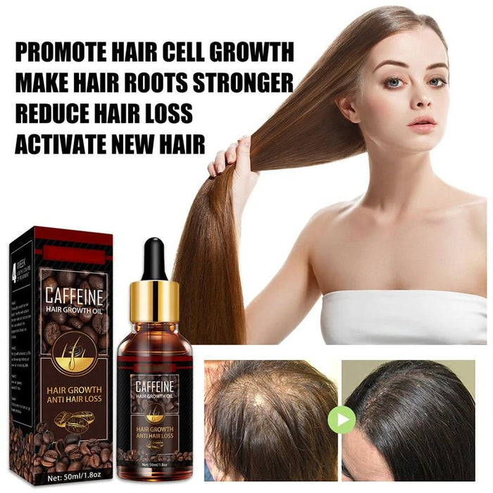 Alopecia Hair Treatment for Women Hairloss Hair Oil Growth Tool Spray Caffeine for Treatment Dry Frizzy Damaged Thin Hair Care